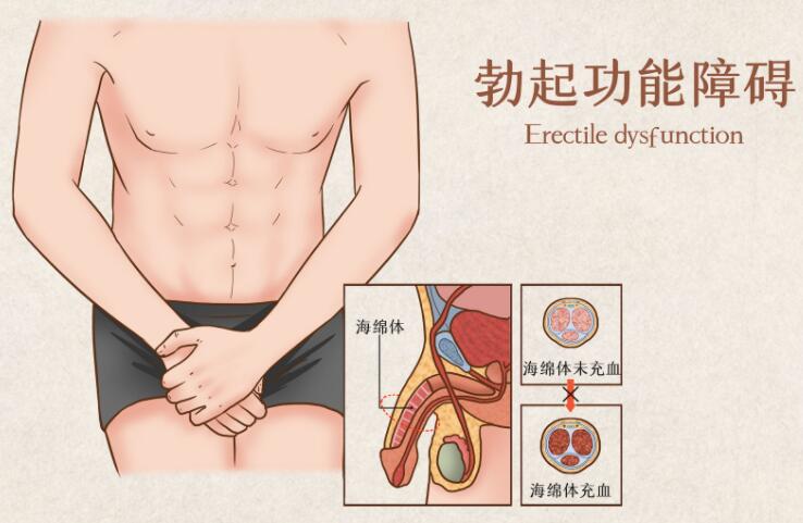 <a href='http://www.0564kynk.com/' target='_blank'><u>洛阳男科医院</u></a>介绍哪些男性更容易出现性功能问题以及如何预防